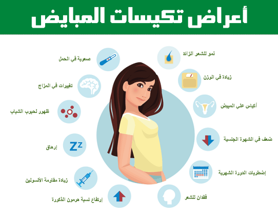 أعراض تكيسات المبايض أعراض تكيسات المبايض