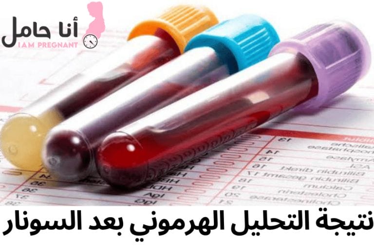 نتيجة التحليل الهرموني بعد السونار