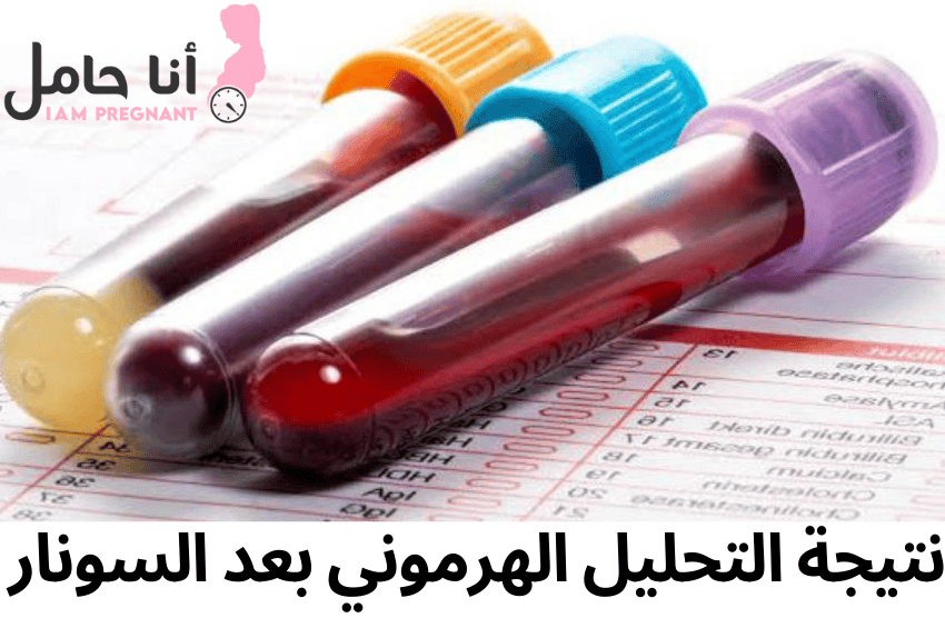 نتيجة التحليل الهرموني بعد السونار