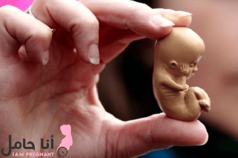 ماهي أسباب الإجهاض المتكرر