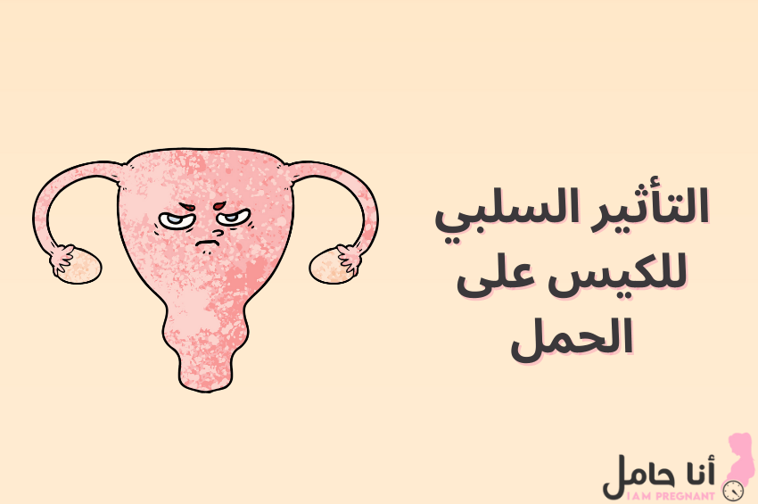أسباب وجود كيس خارج الرحم أثناء الحمل