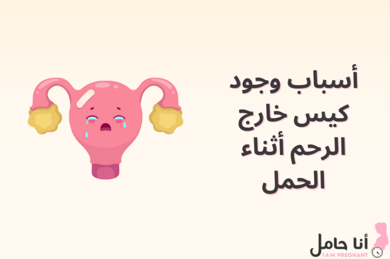 أسباب وجود كيس خارج الرحم أثناء الحمل