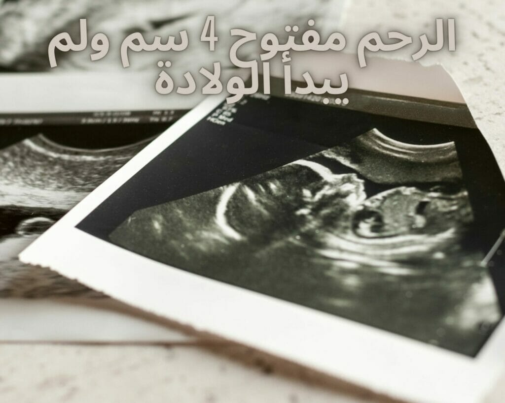 الرحم مفتوح 4 سم ولم يبدأ الولادة