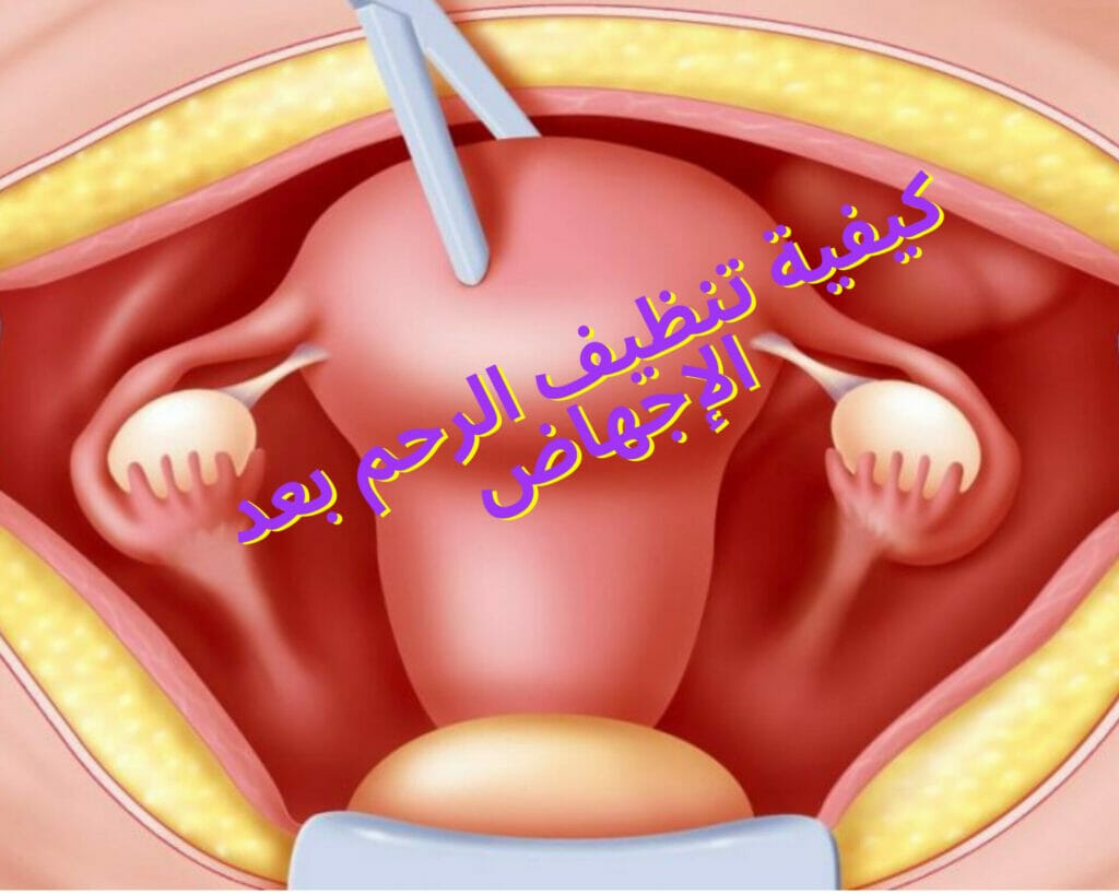 كيفية تنظيف الرحم بعد الإجهاض
