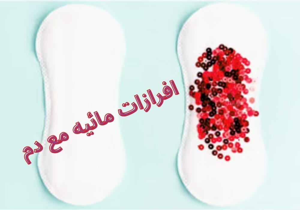 افرازات مائيه مع دم