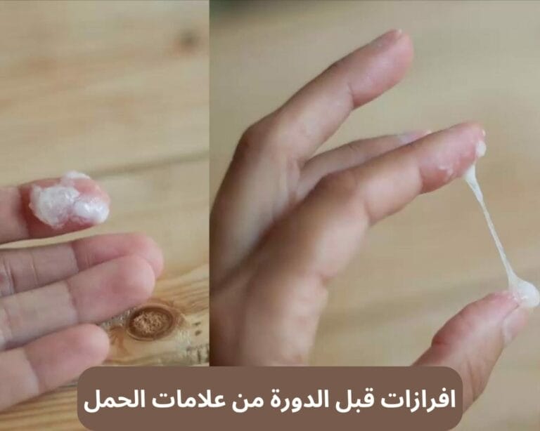 افرازات قبل الدورة من علامات الحمل